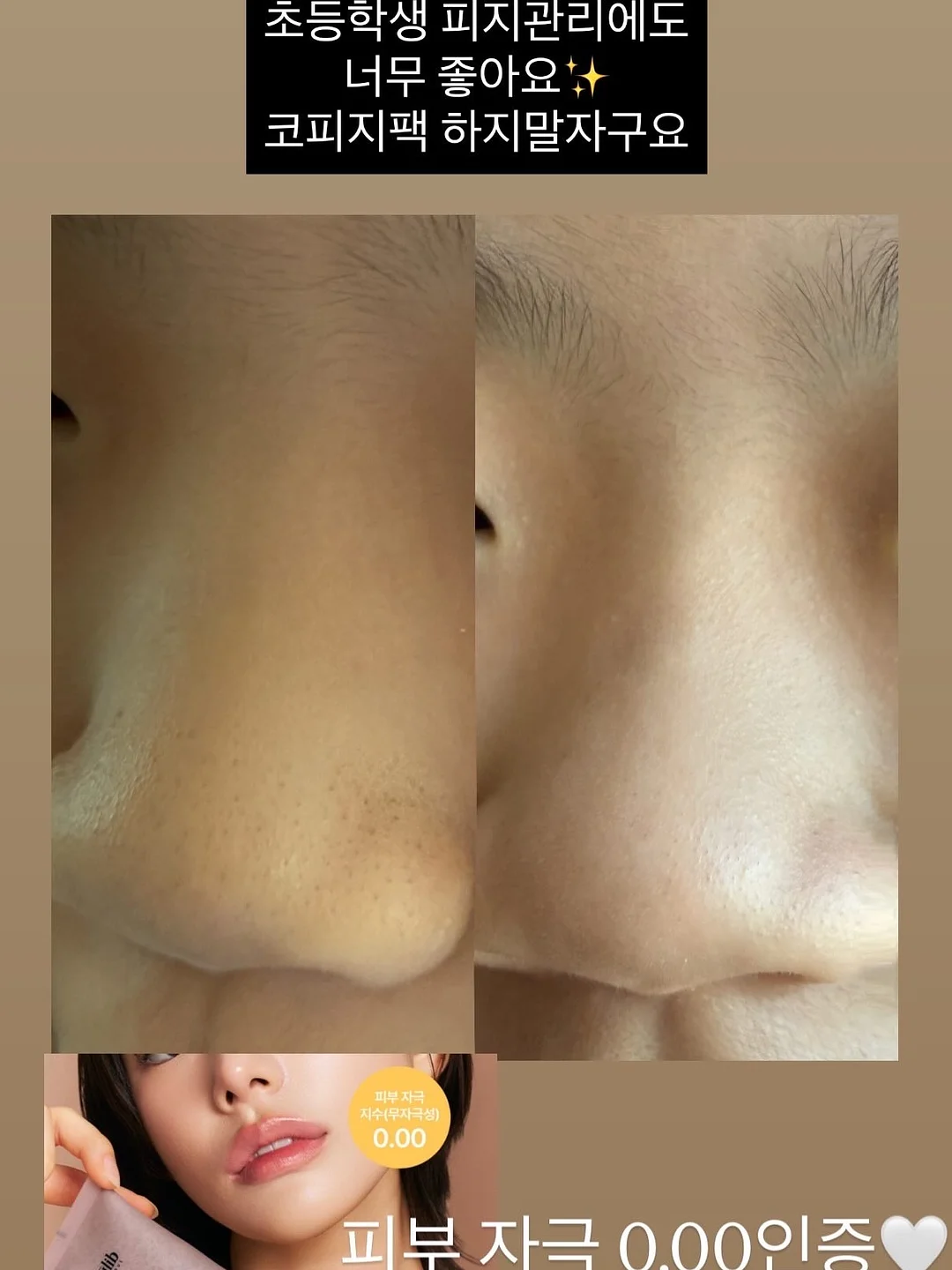 실리콘 조절 밴드 6