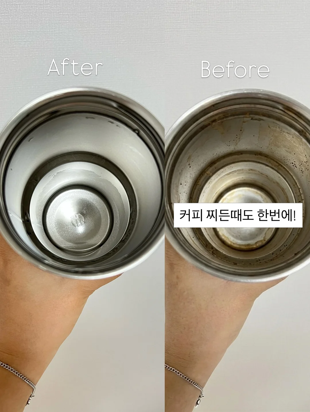 입호흡 습관 교정 7