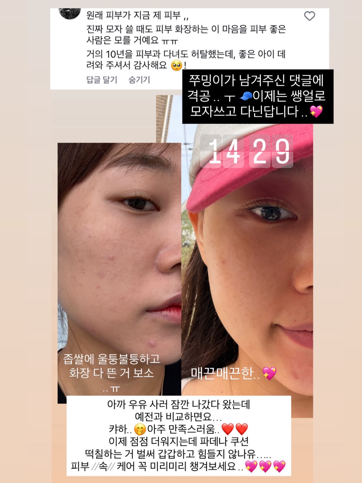 얼룩 제거기 11