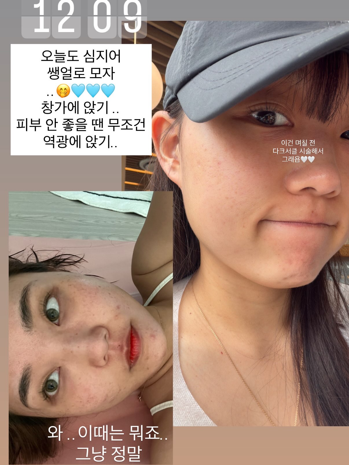 얼룩 제거기 12