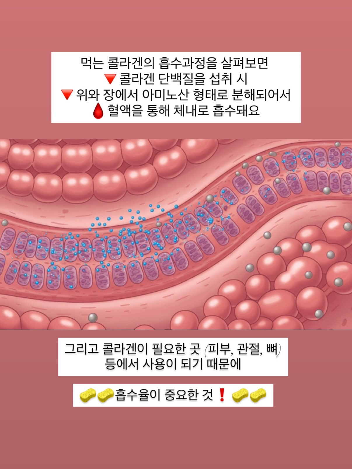 얼룩 제거기 13