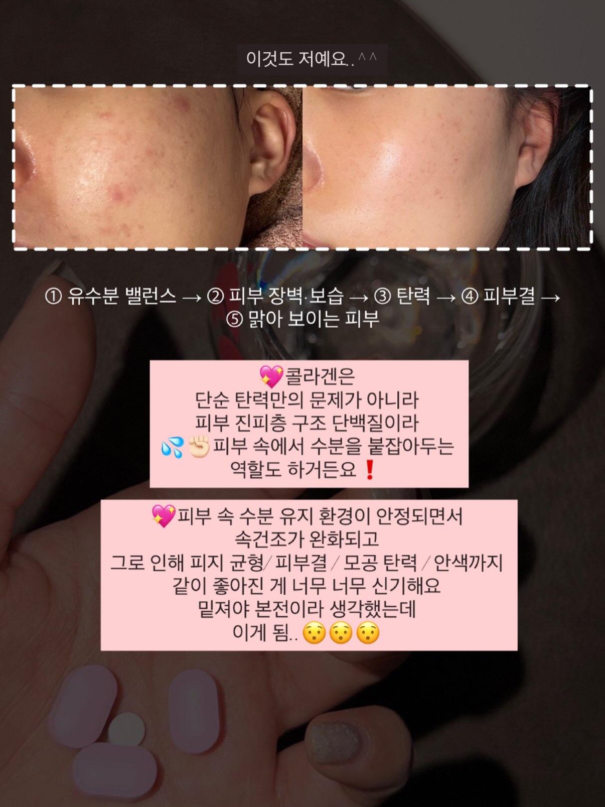 얼룩 제거기 4