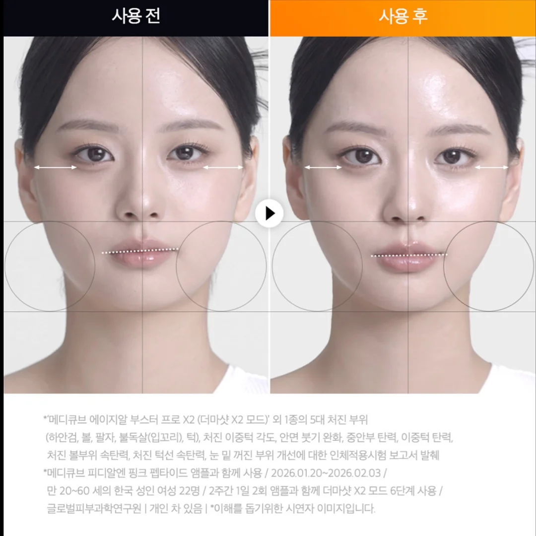 먹태기 온 애기/부모님/남편 잘먹템 13