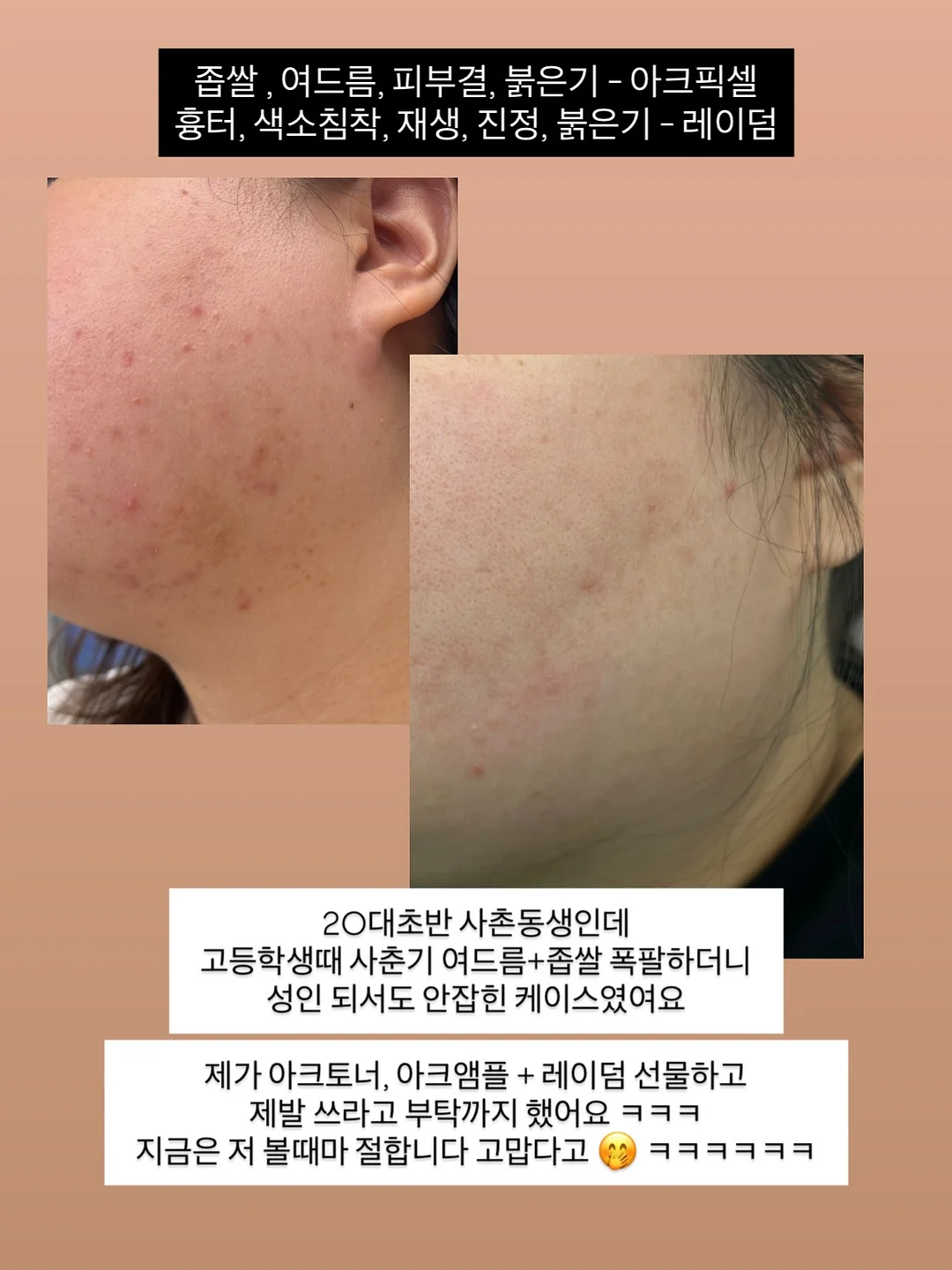 차량용 냉온 컵홀더 1