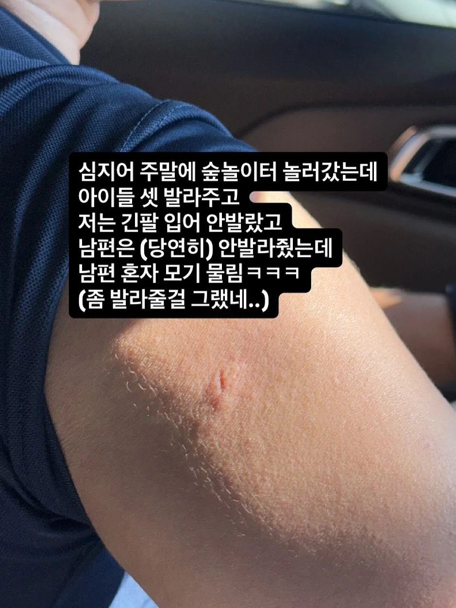 린넨 탑 레이스 스커트 세트 7