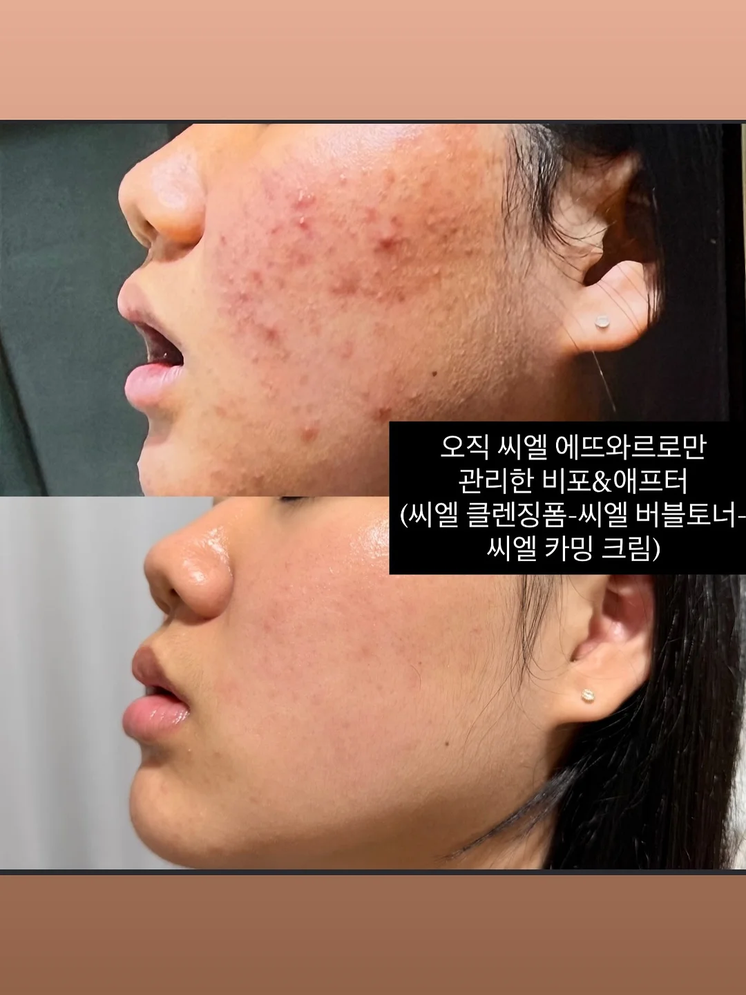 쭈꾸미 1