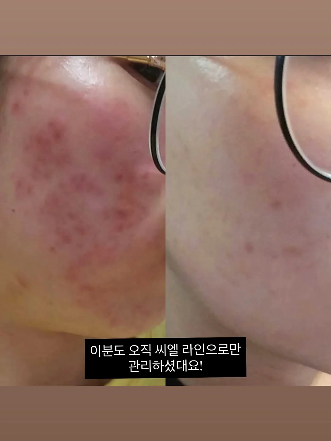 쭈꾸미 3