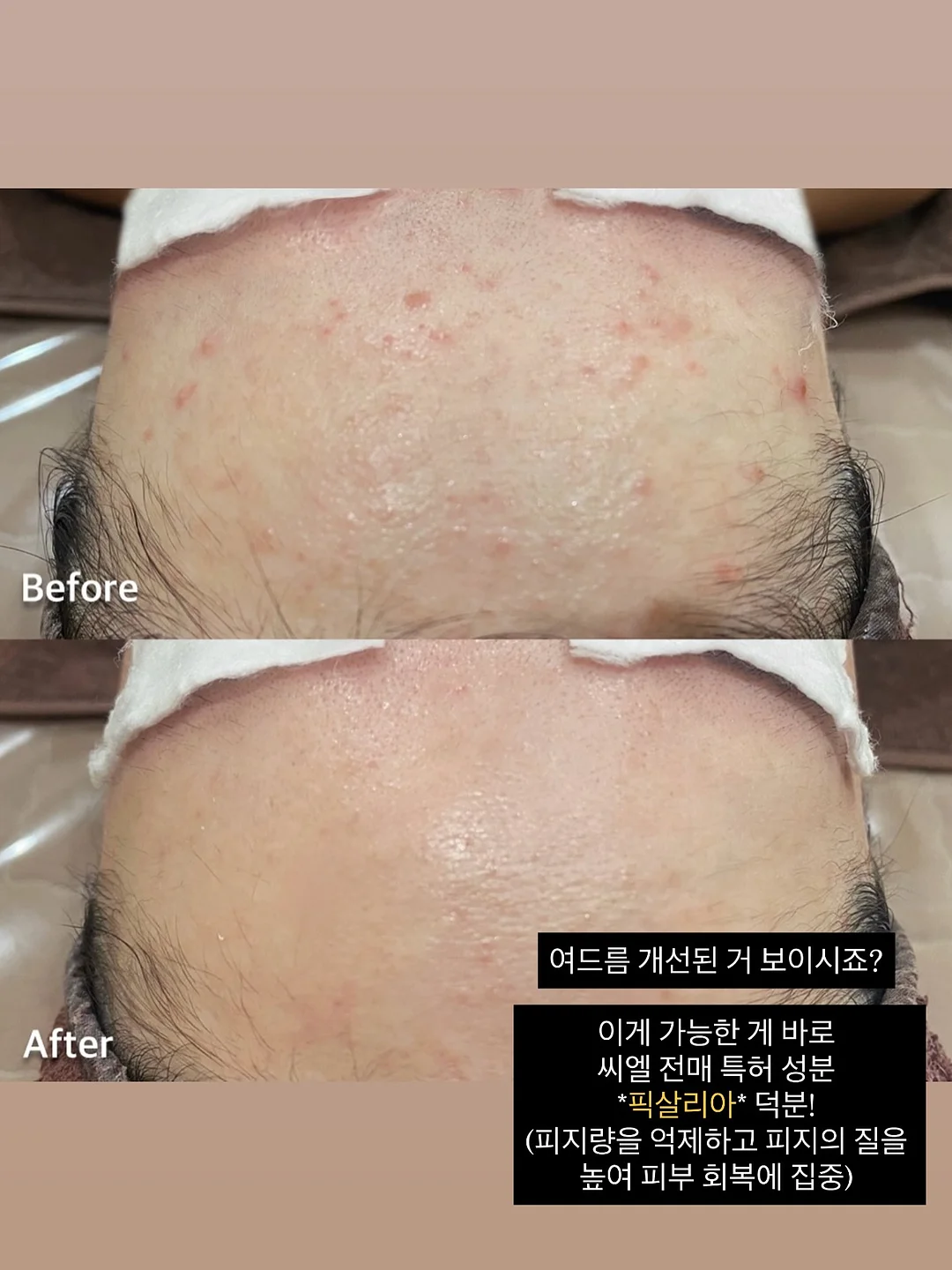 쭈꾸미 5
