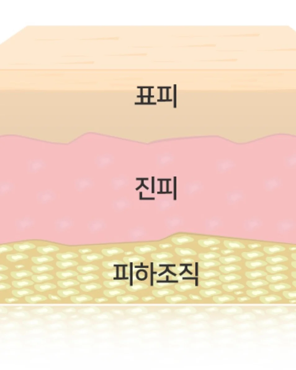 방충망 5