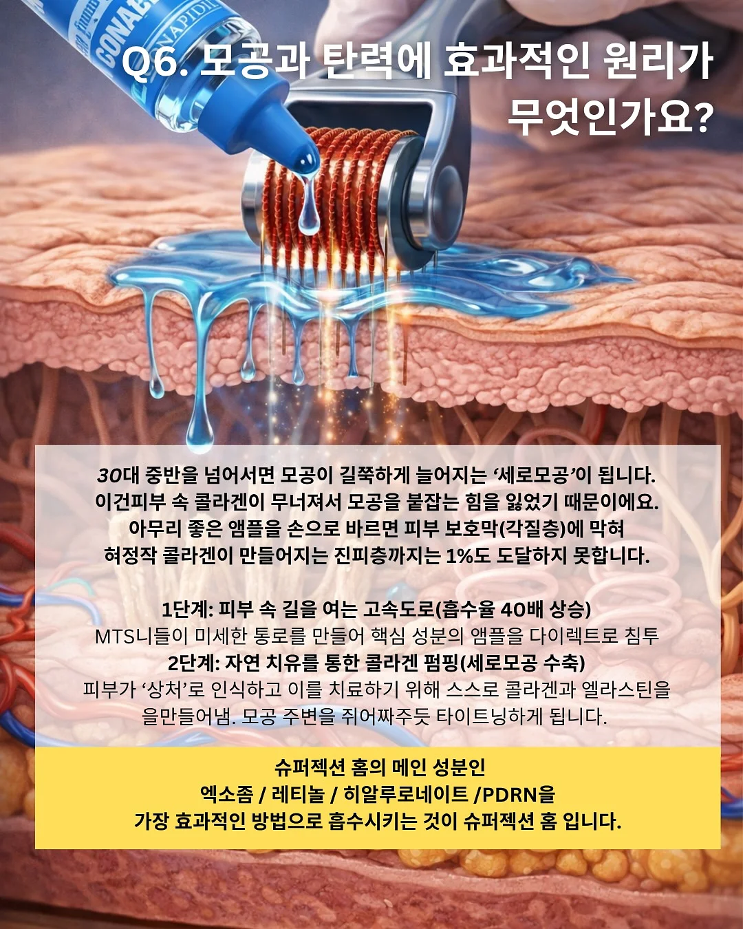 별란김밥 8
