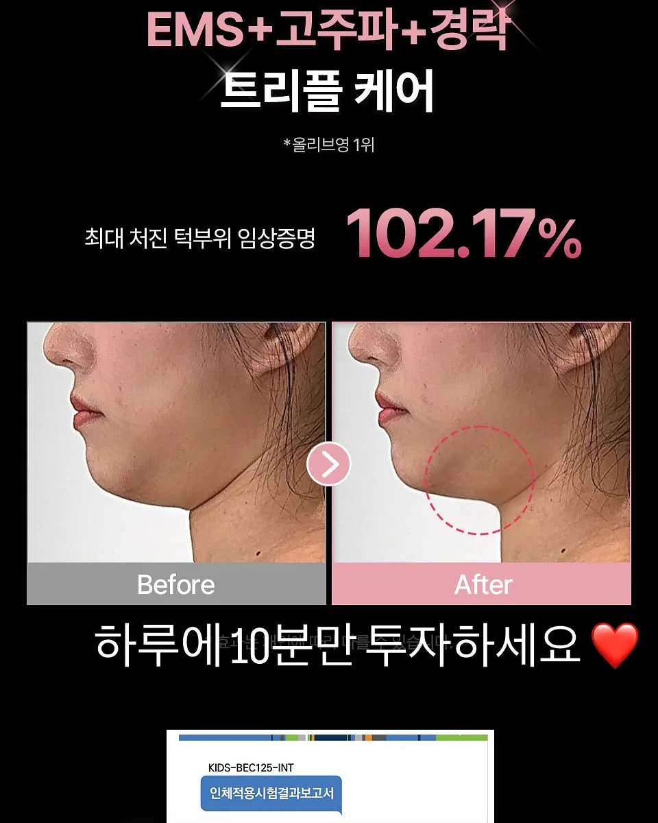 폼스키 6