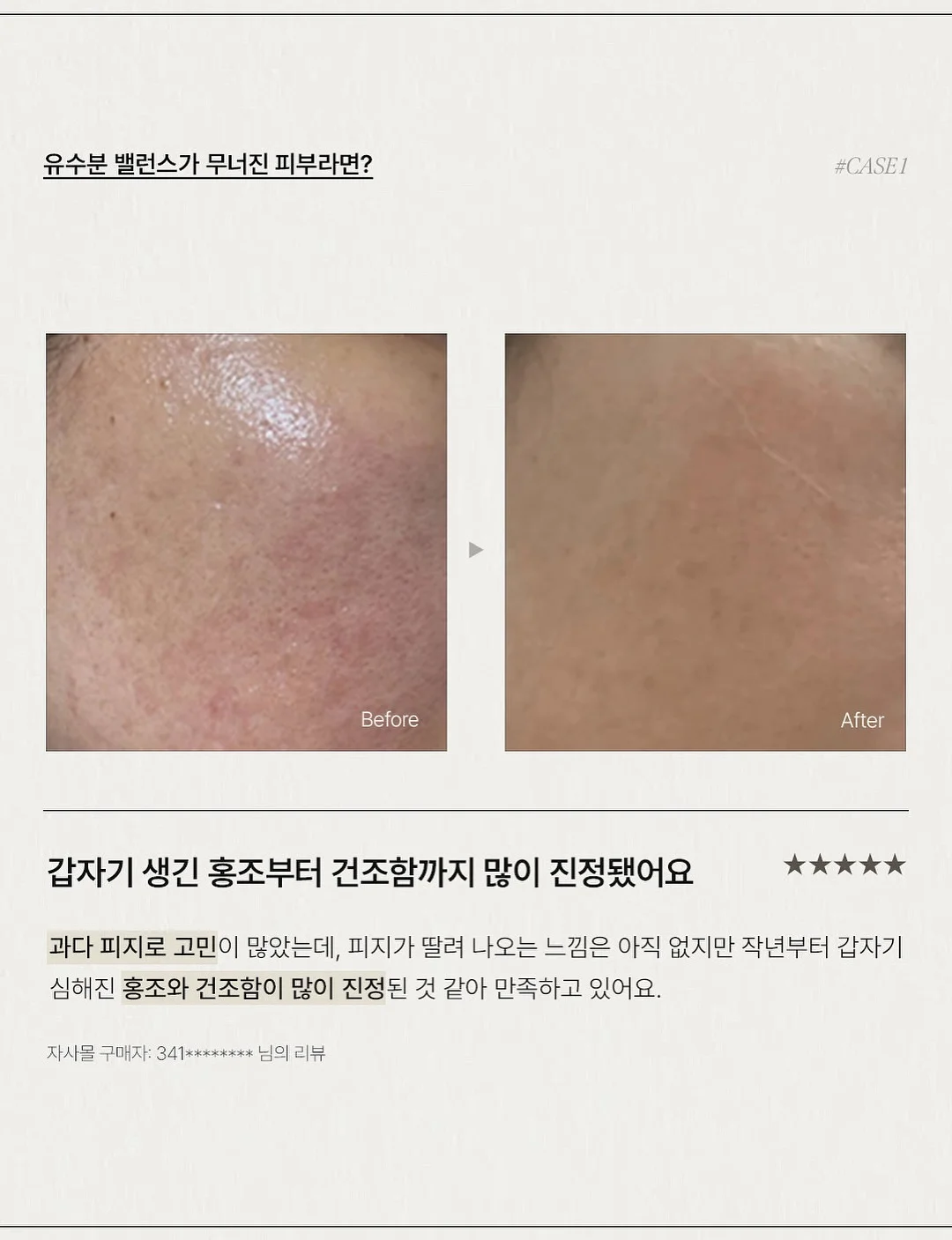 창문 닦이 5