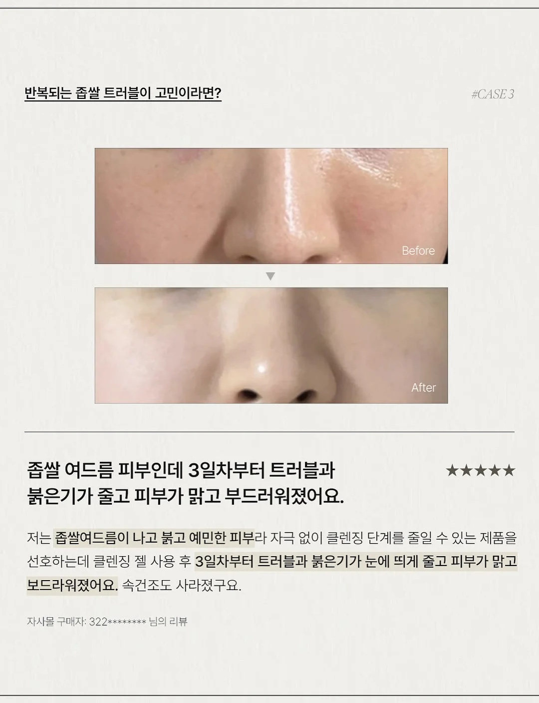 창문 닦이 6