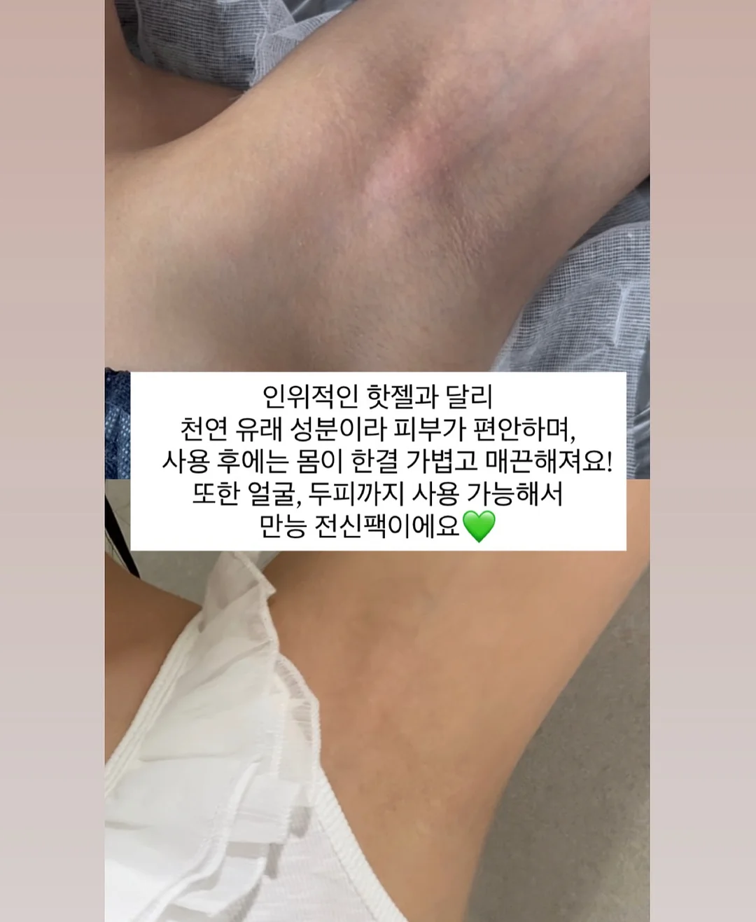 차앤박피부과 맞춤 프로그램 12