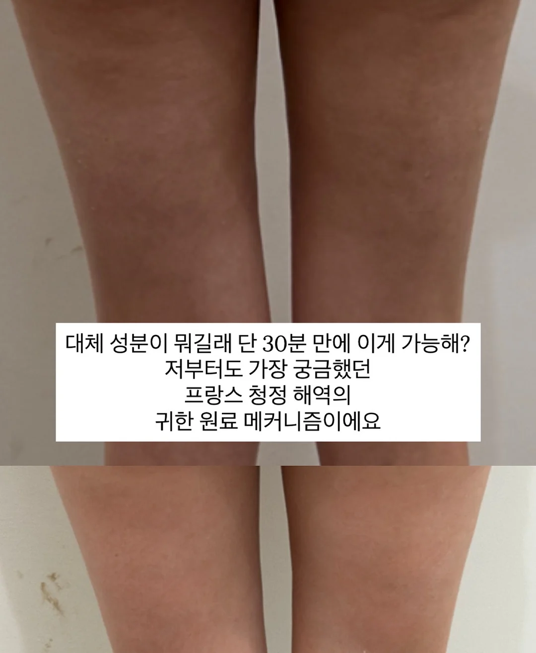 차앤박피부과 맞춤 프로그램 2