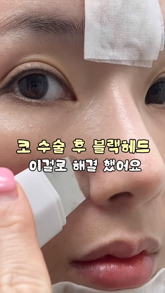 로만쉐이드