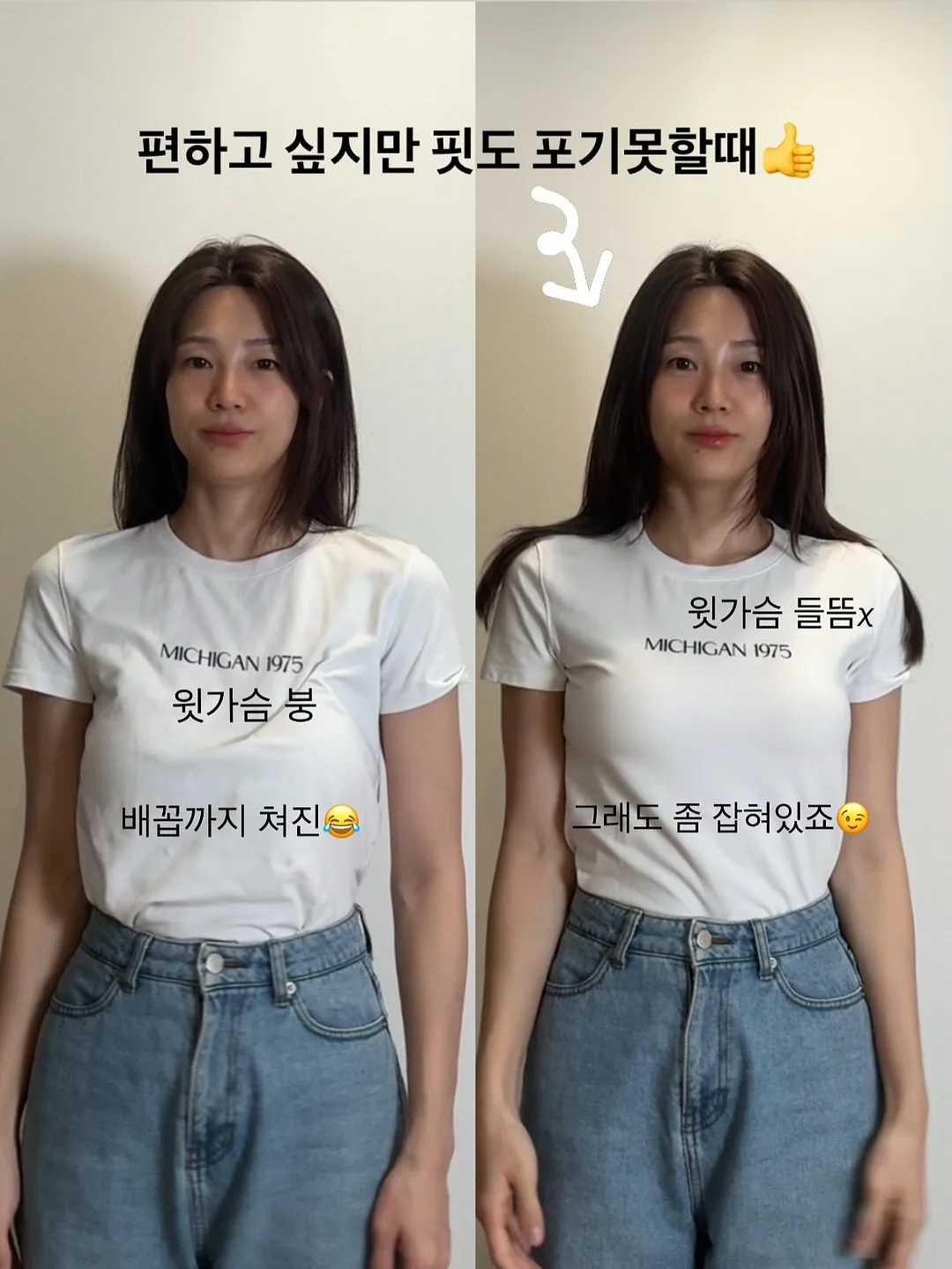 아크네 프로 겔제, 아크네 프로 크림제 2
