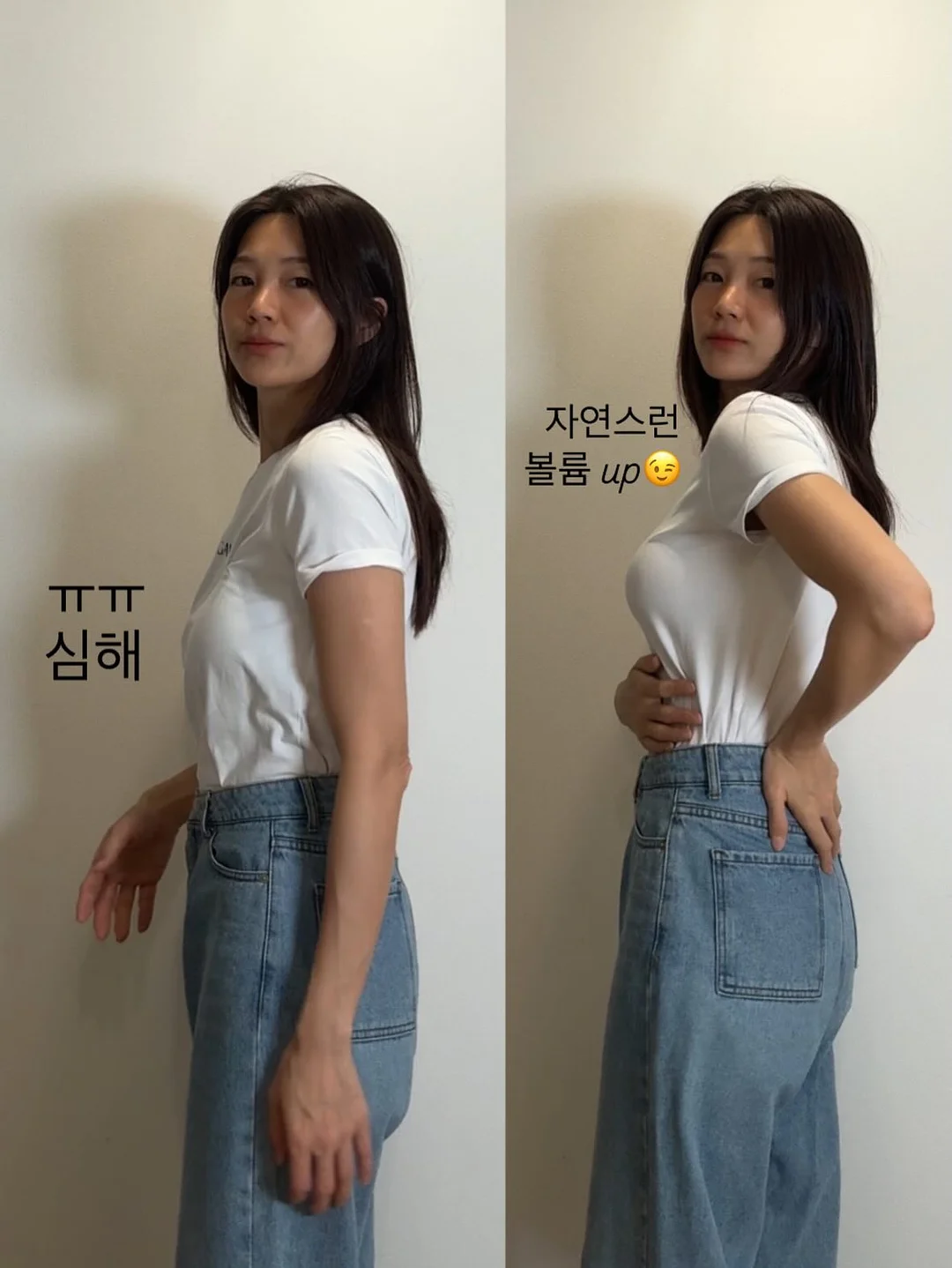 아크네 프로 겔제, 아크네 프로 크림제 3