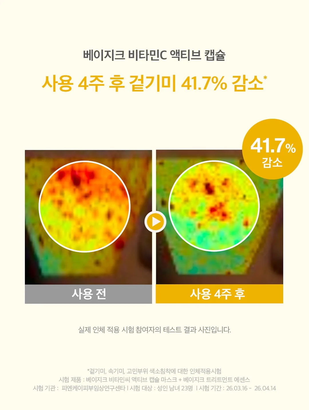 리텐스2 2