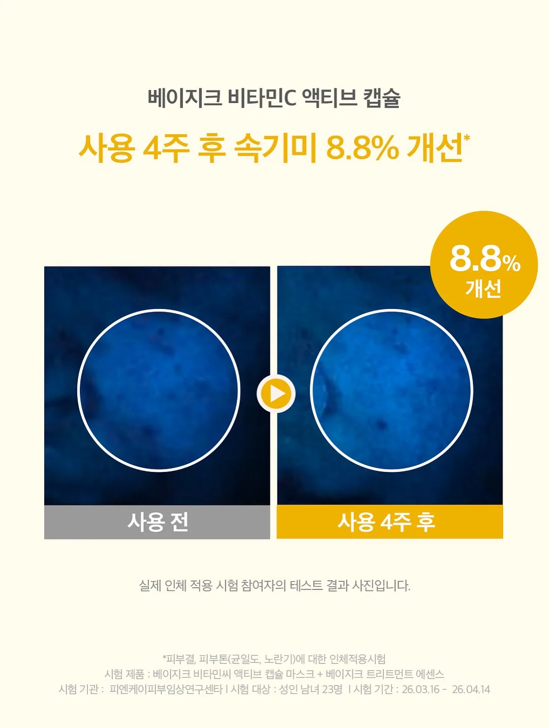리텐스2 6