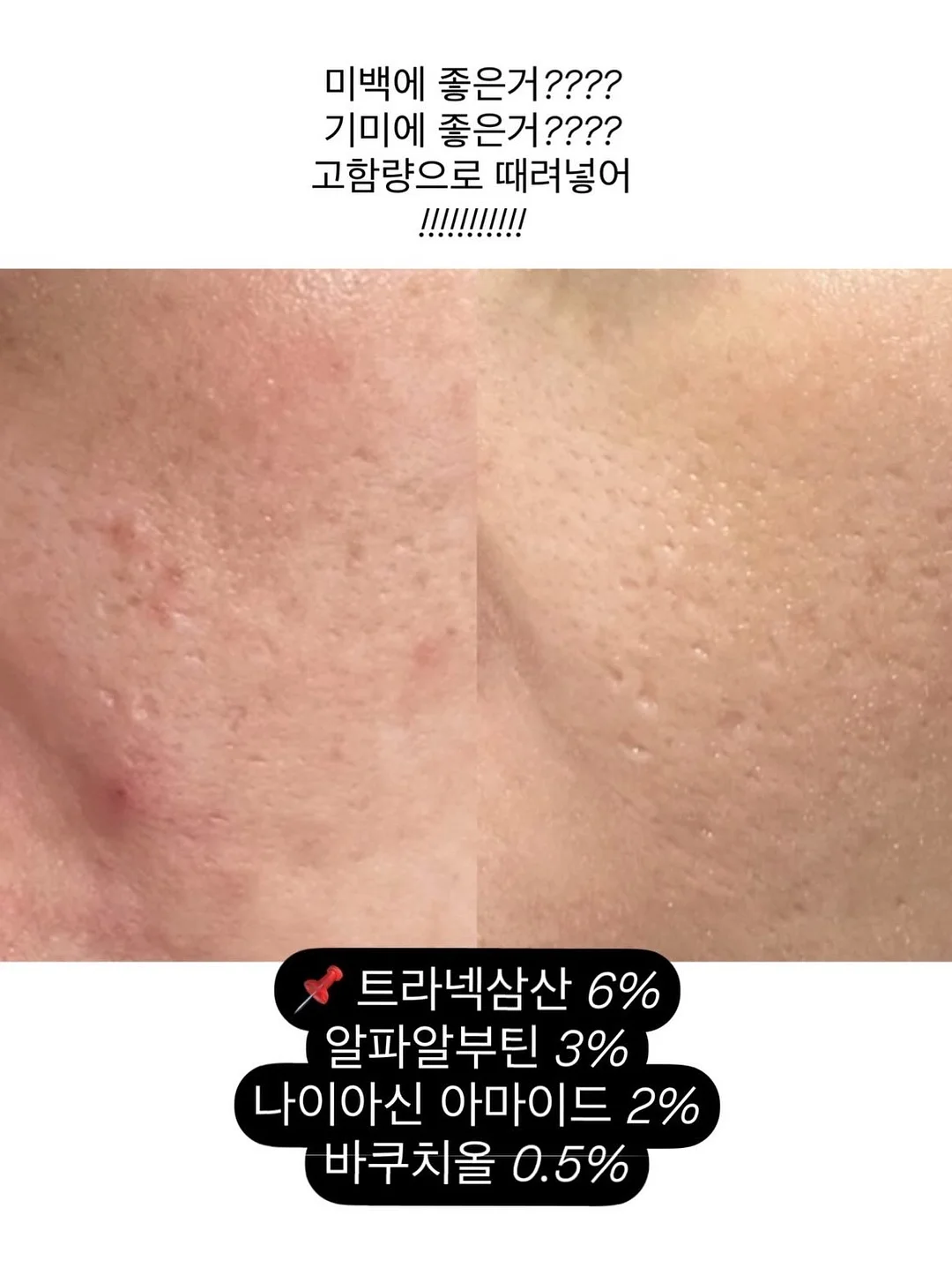 럭셔리 패치 포인트 테일러 자켓 4
