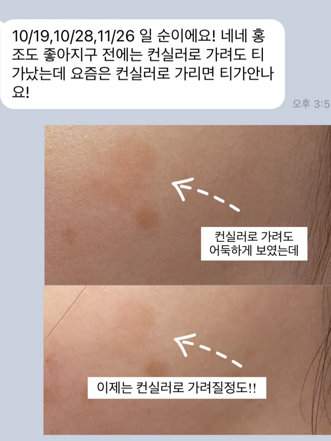 럭셔리 패치 포인트 테일러 자켓 5