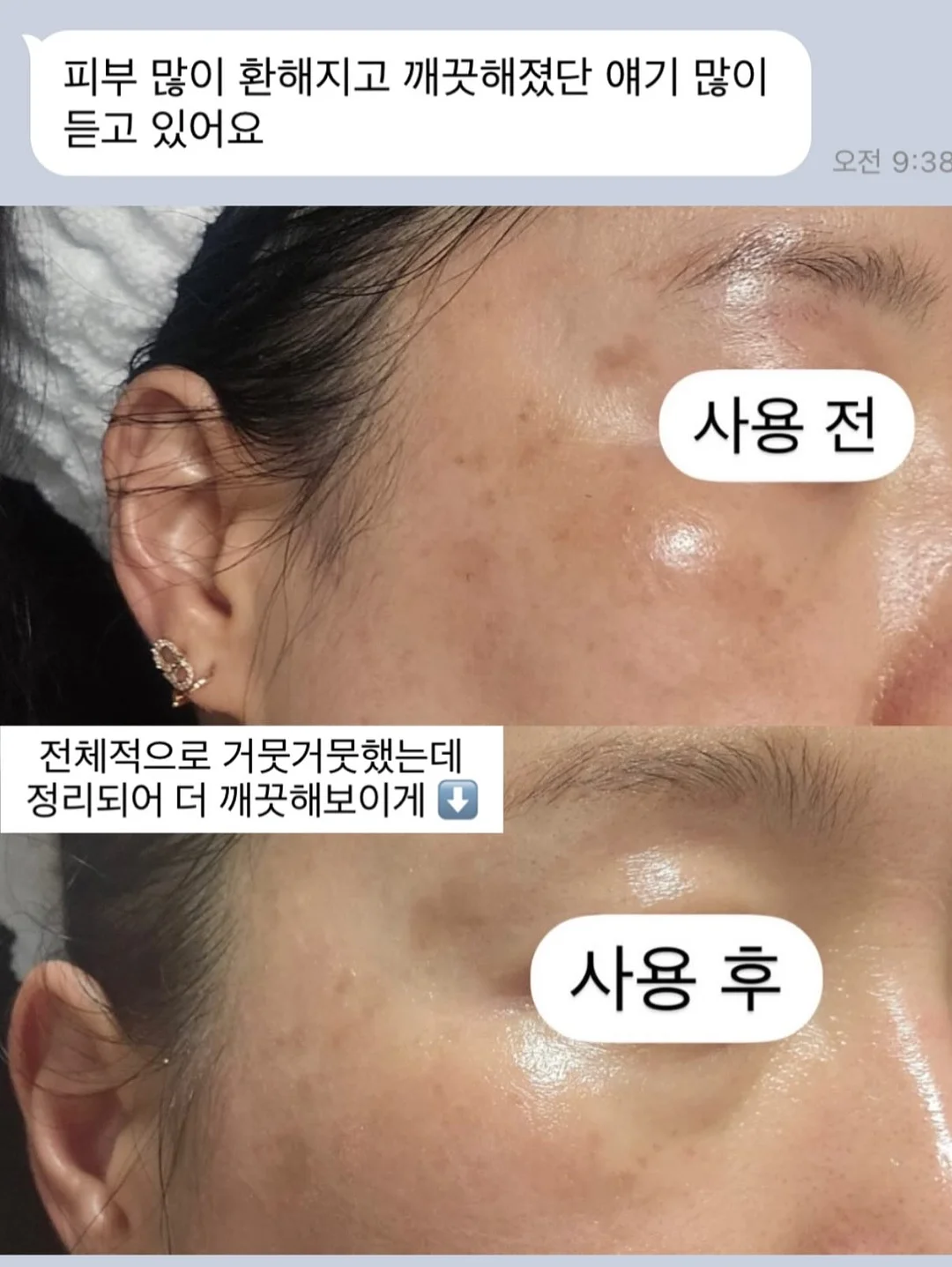 럭셔리 패치 포인트 테일러 자켓 6