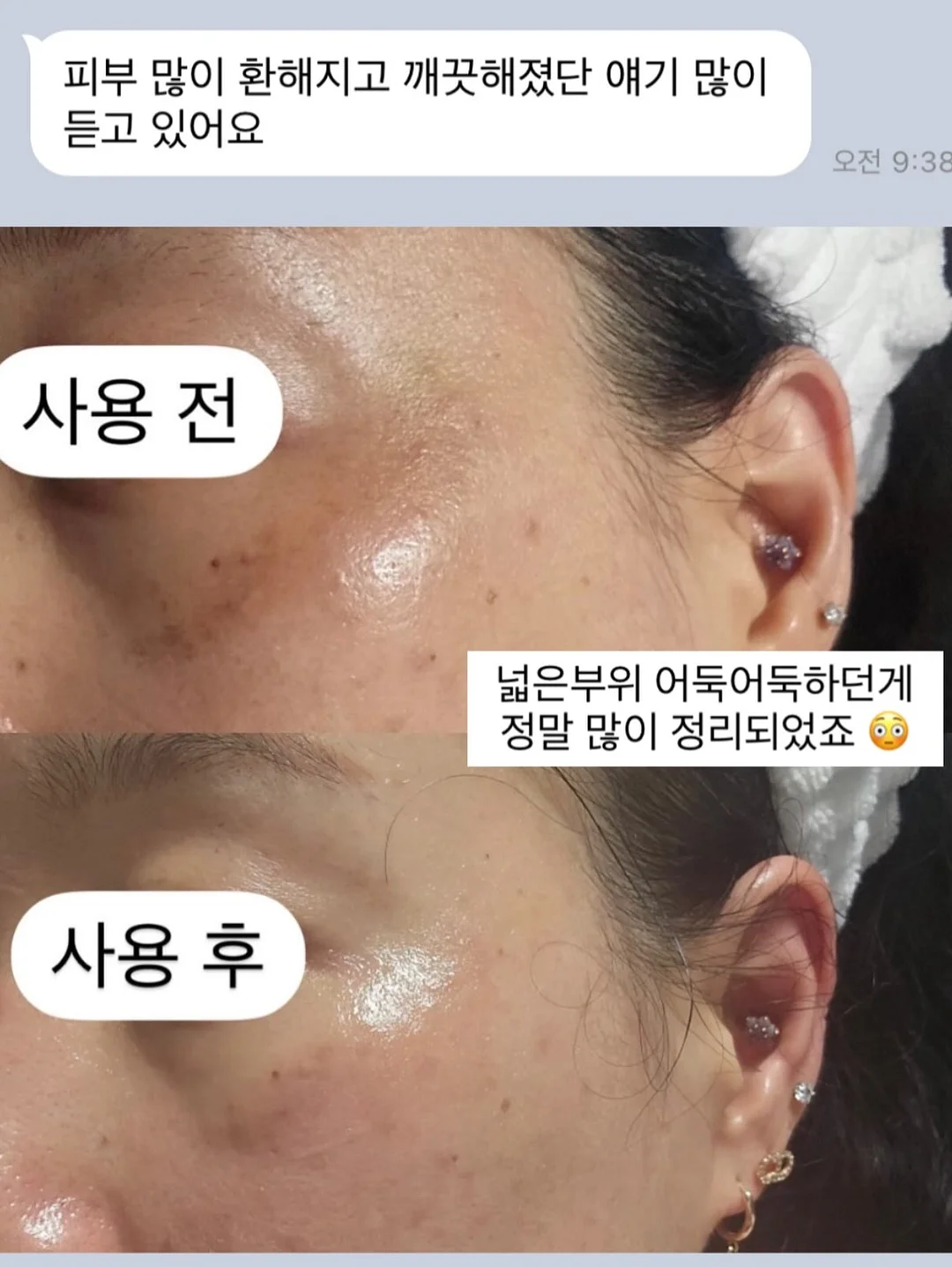 럭셔리 패치 포인트 테일러 자켓 7
