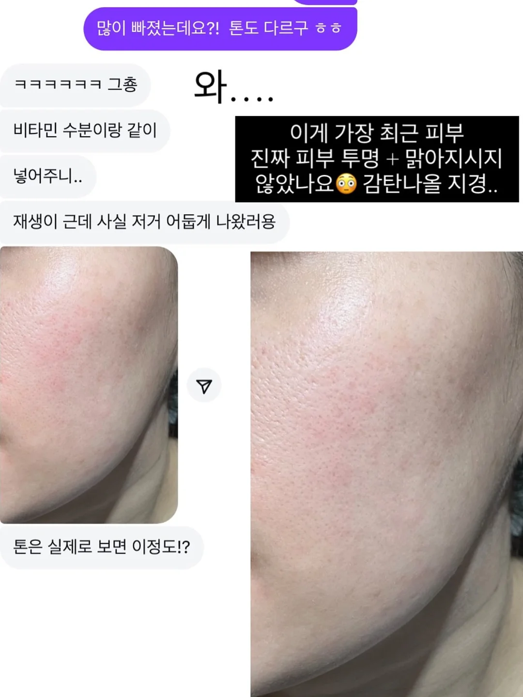 럭셔리 패치 포인트 테일러 자켓 9