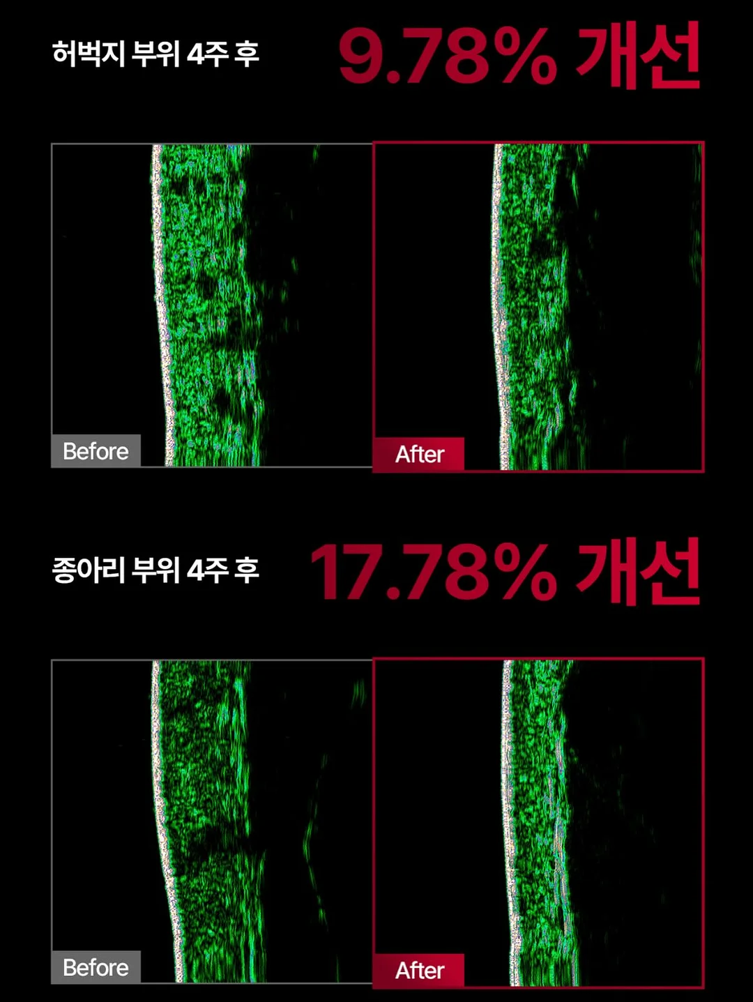 카다멈 번, 시나몬 번 19
