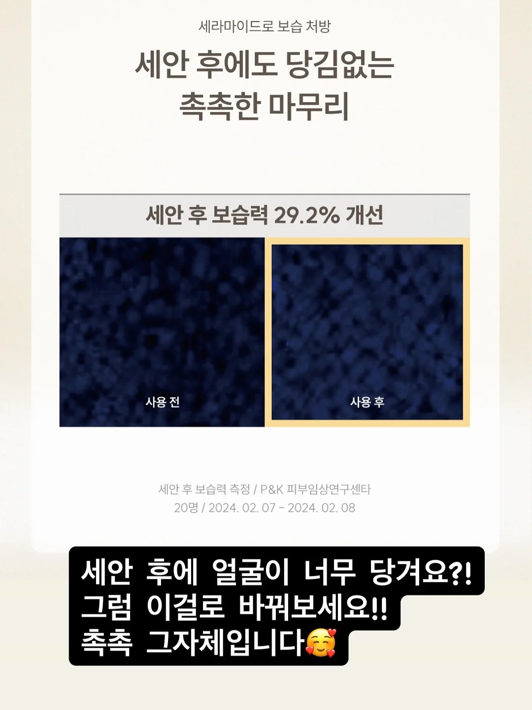 차량용 스마트 썬팅 16