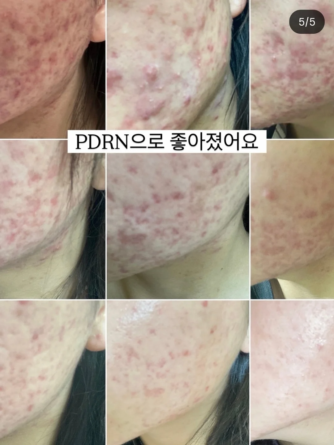 해동트레이 2