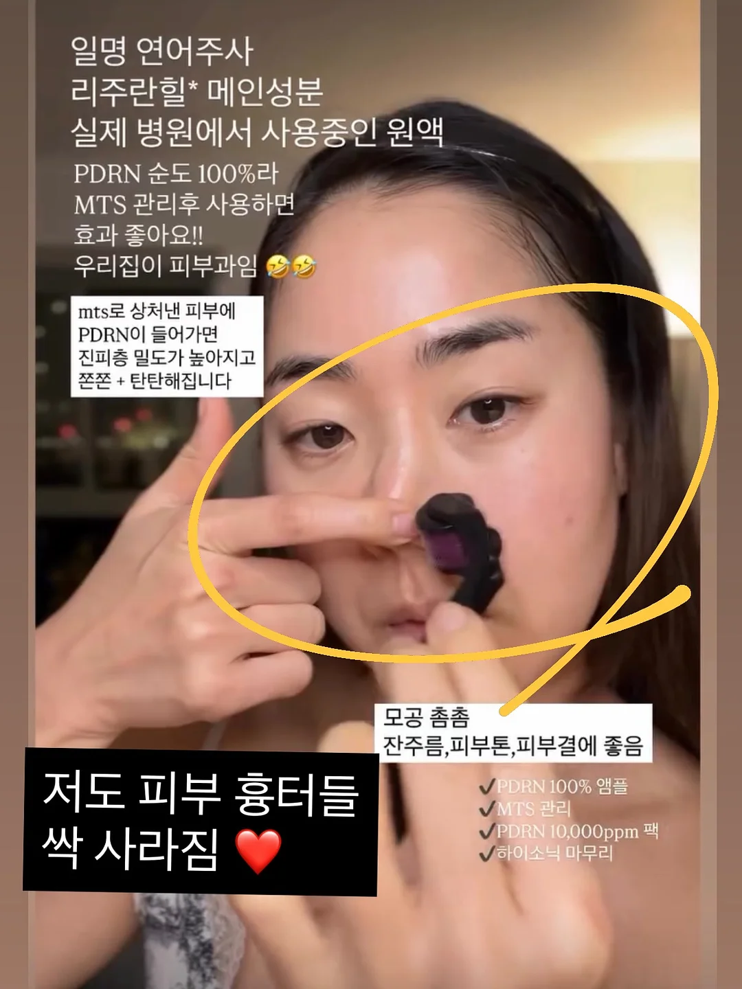 해동트레이 5