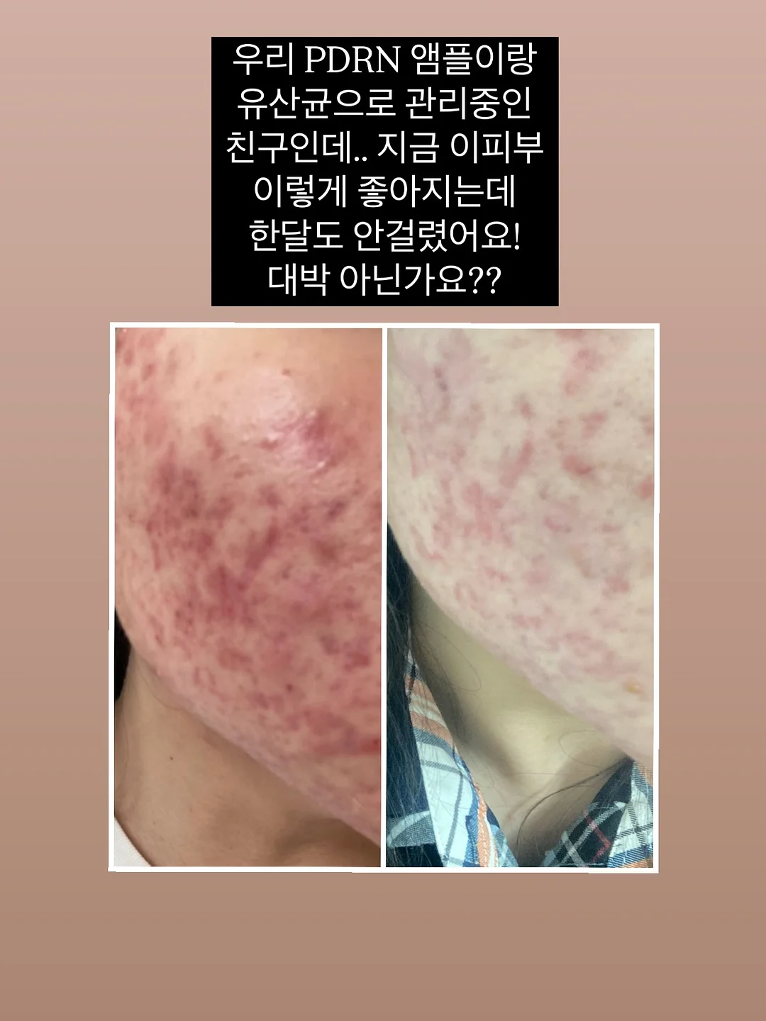 해동트레이 10