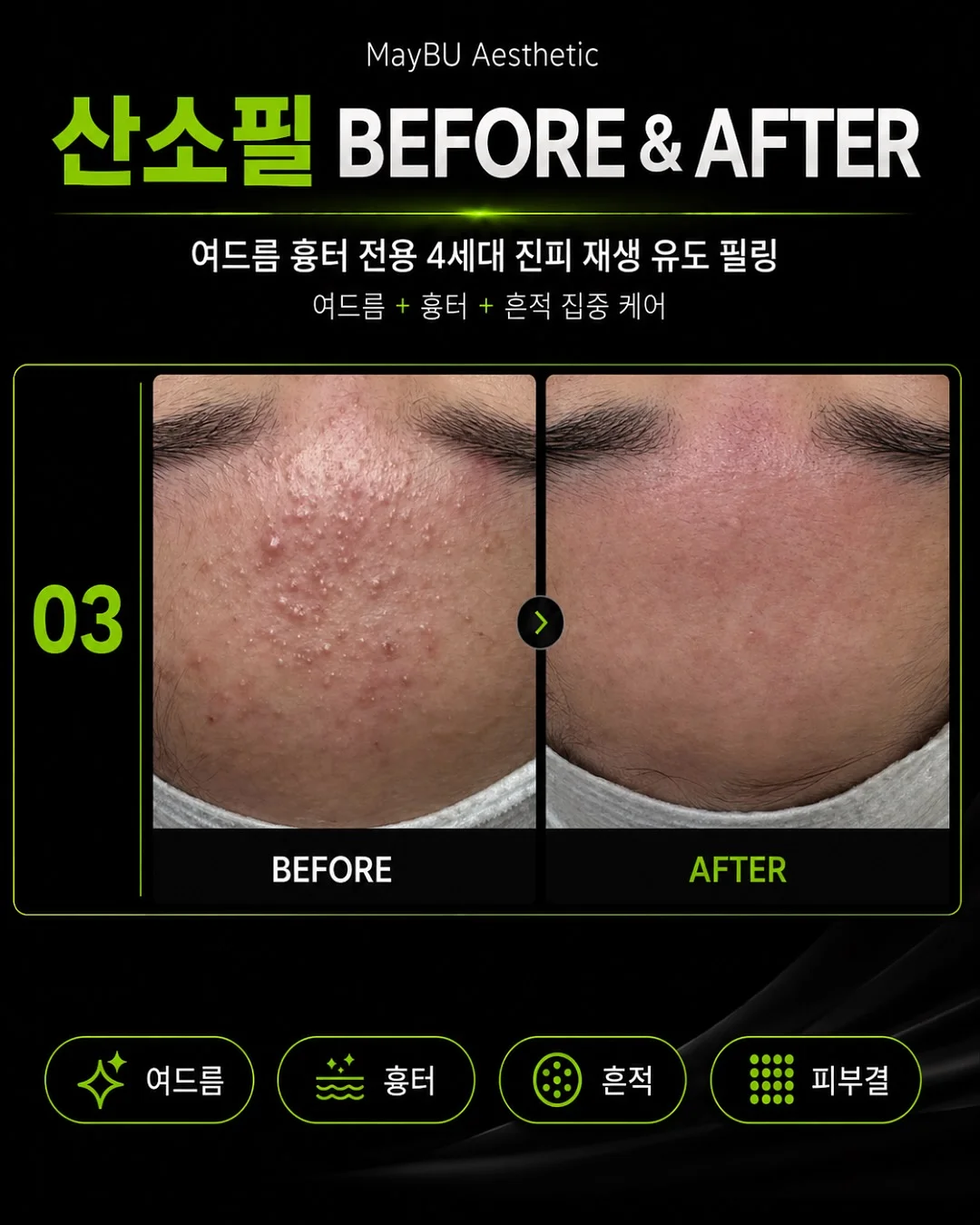 10년 뒤 미래 예언 프롬프트 2