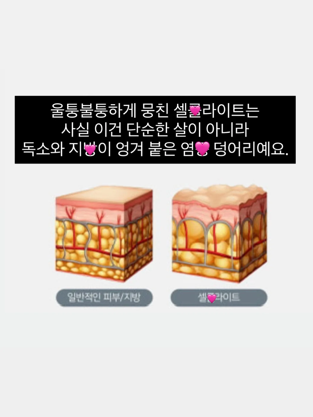 바이오메라 키즈 유산균 9