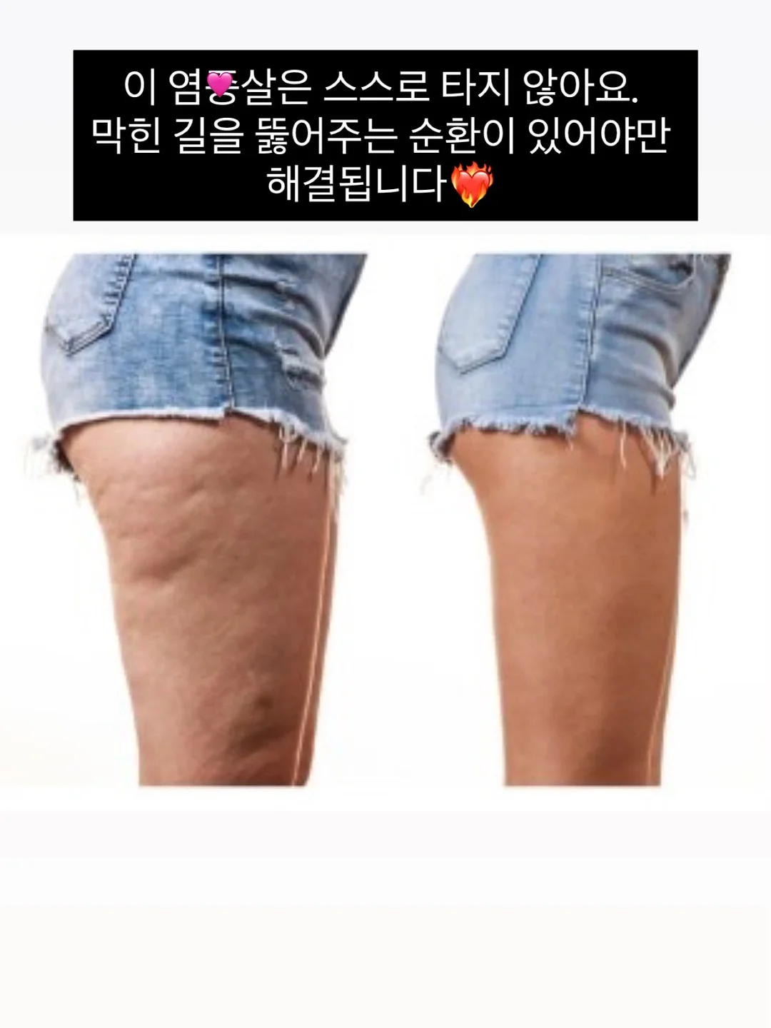 바이오메라 키즈 유산균 10