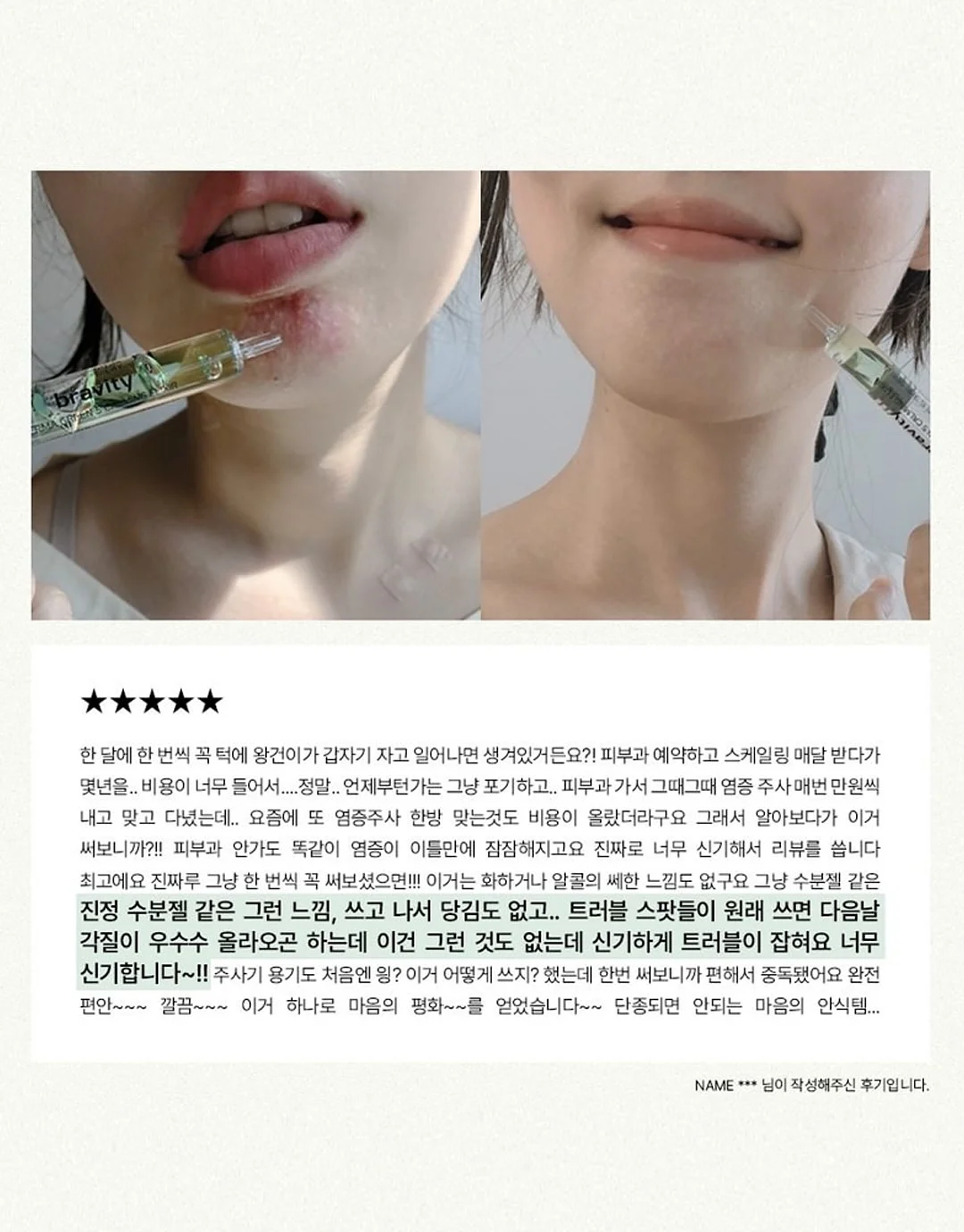 아디다스 바람막이 레드 그레이 12