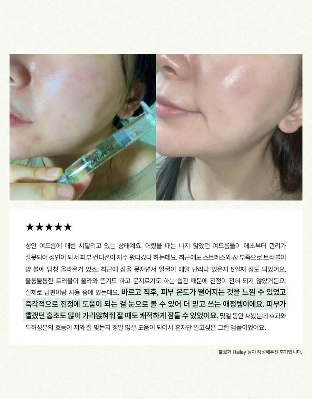 아디다스 바람막이 레드 그레이 13