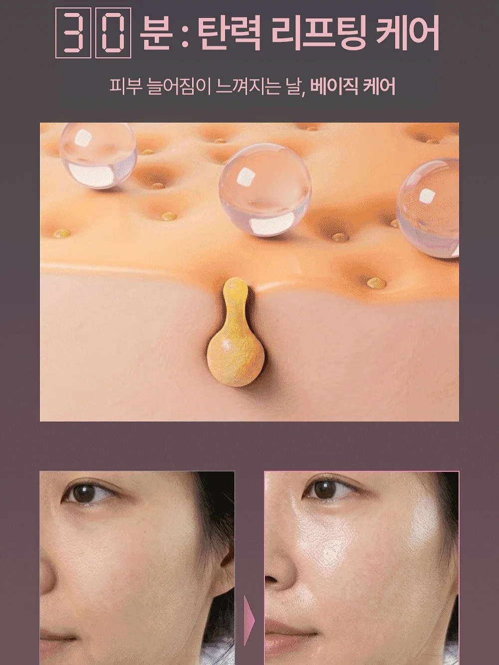 체리장화 14