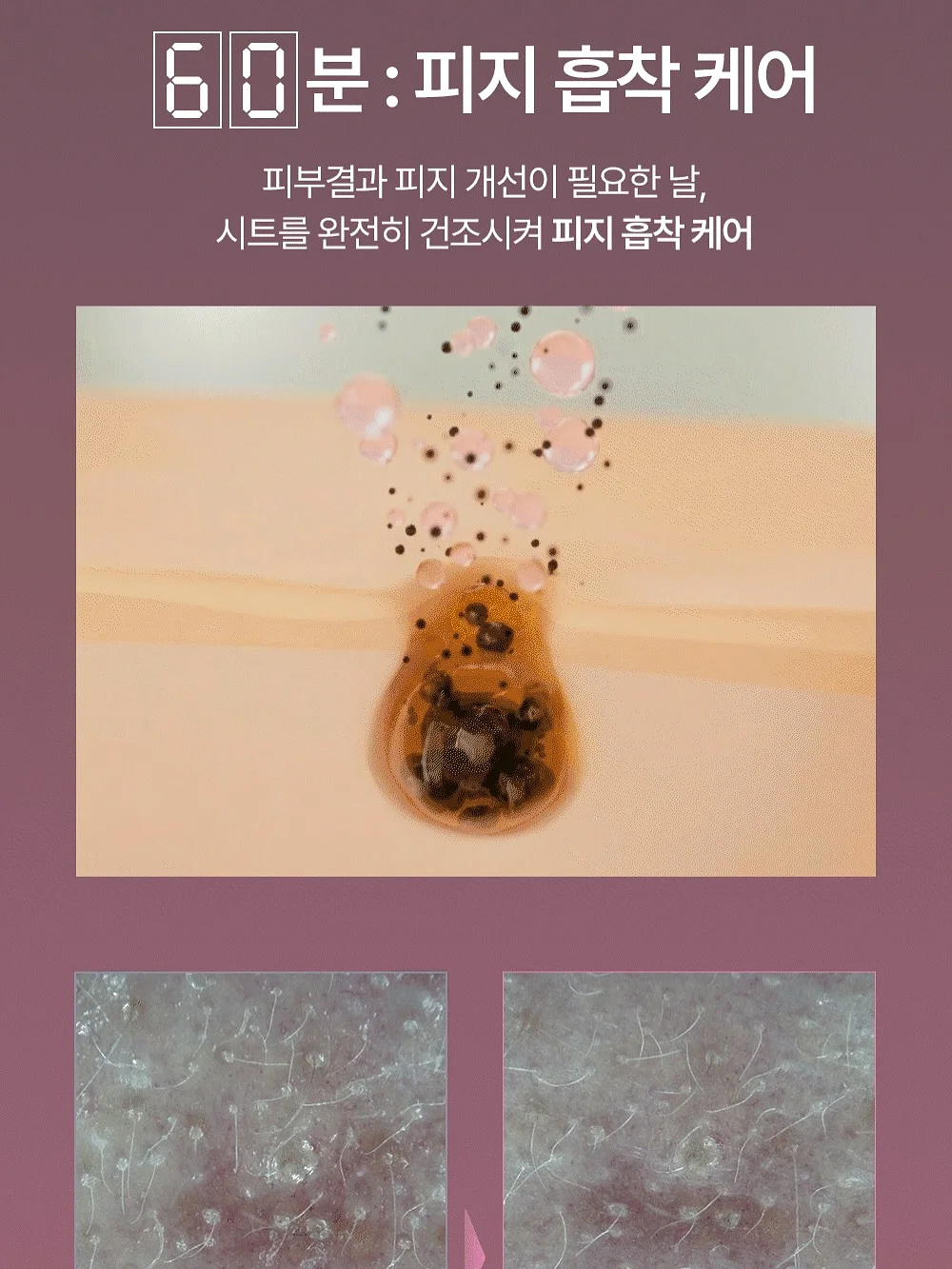 체리장화 15