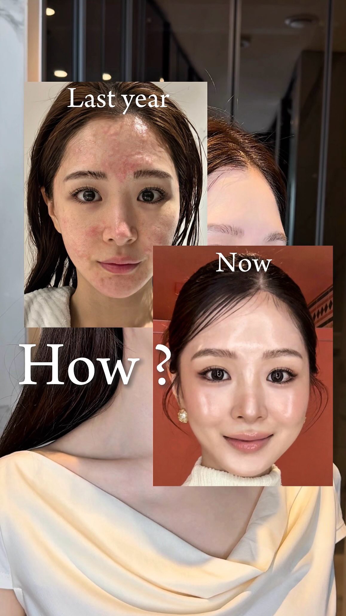 실버백