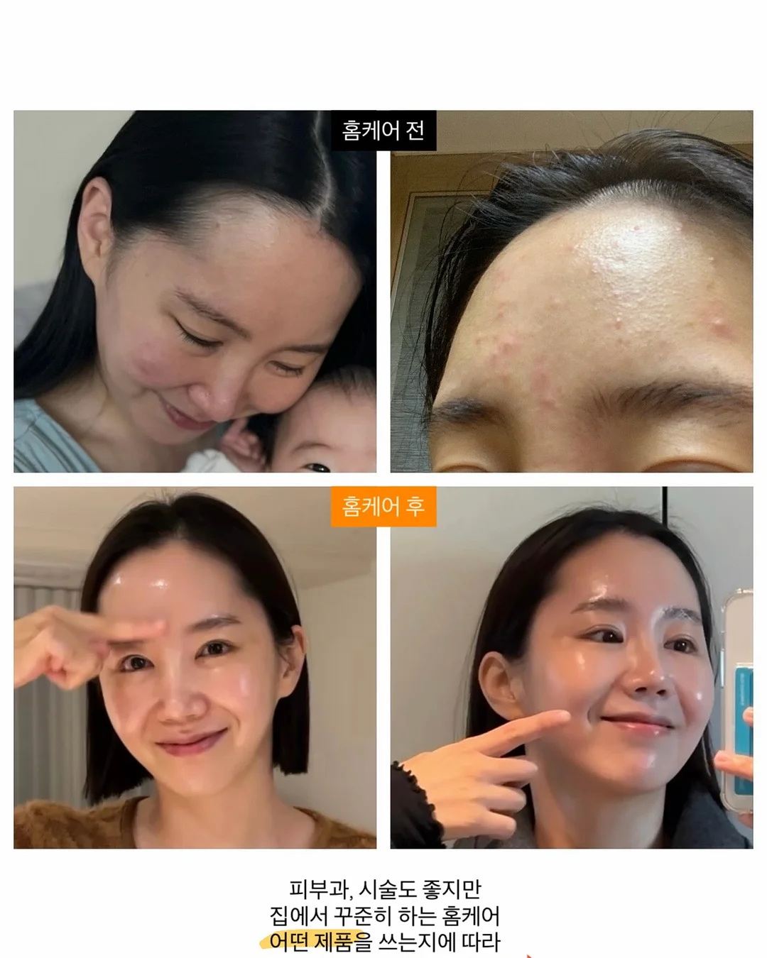 블루안트 휴대용 목걸이선풍기 2