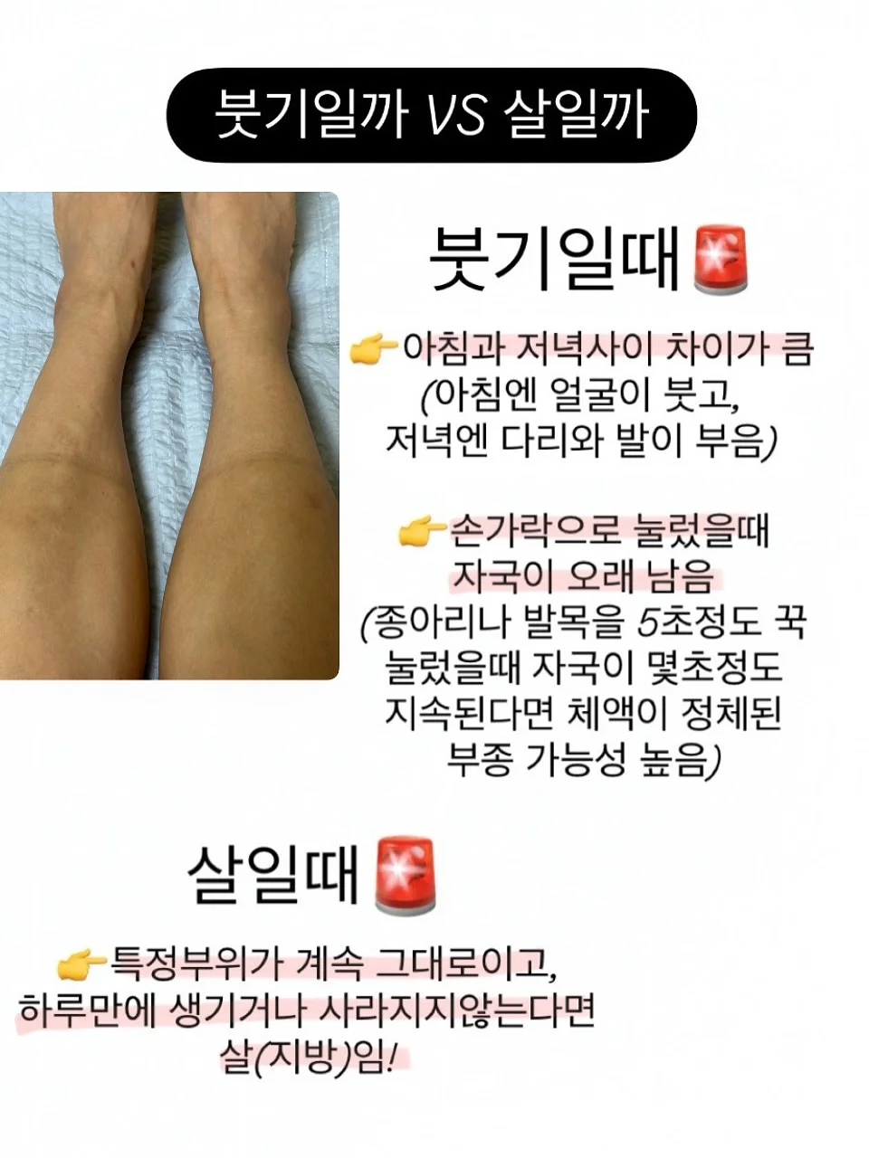 굿사이클링 캠페인 키캡키링 8
