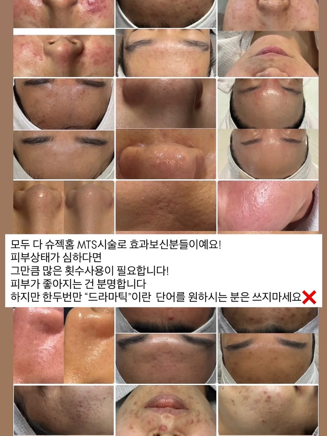 손가락 양치 패드 15