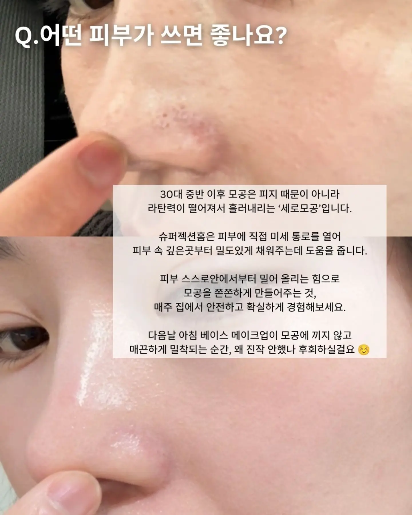 미미재 7월 앵콜 클래스 5