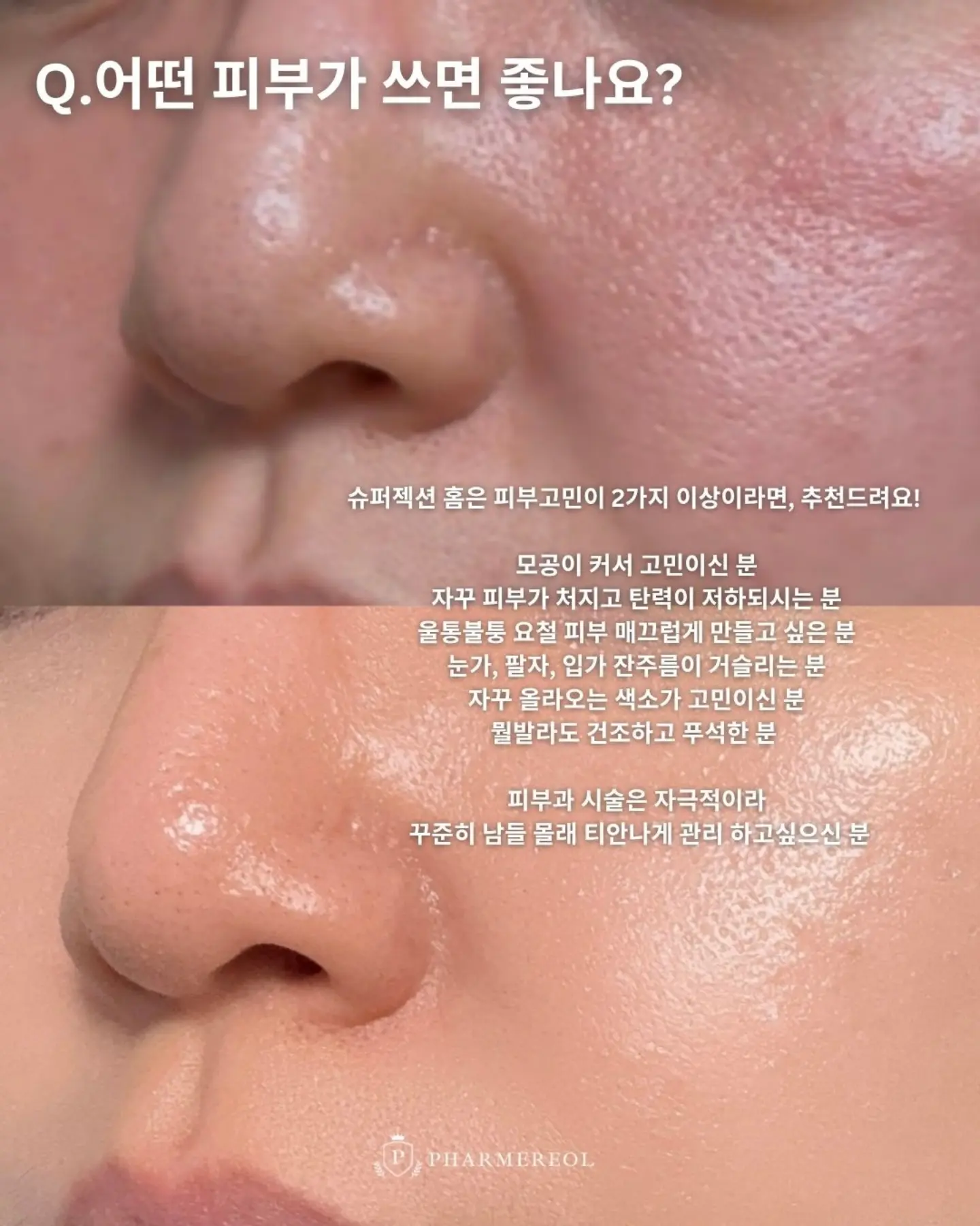 미미재 7월 앵콜 클래스 6