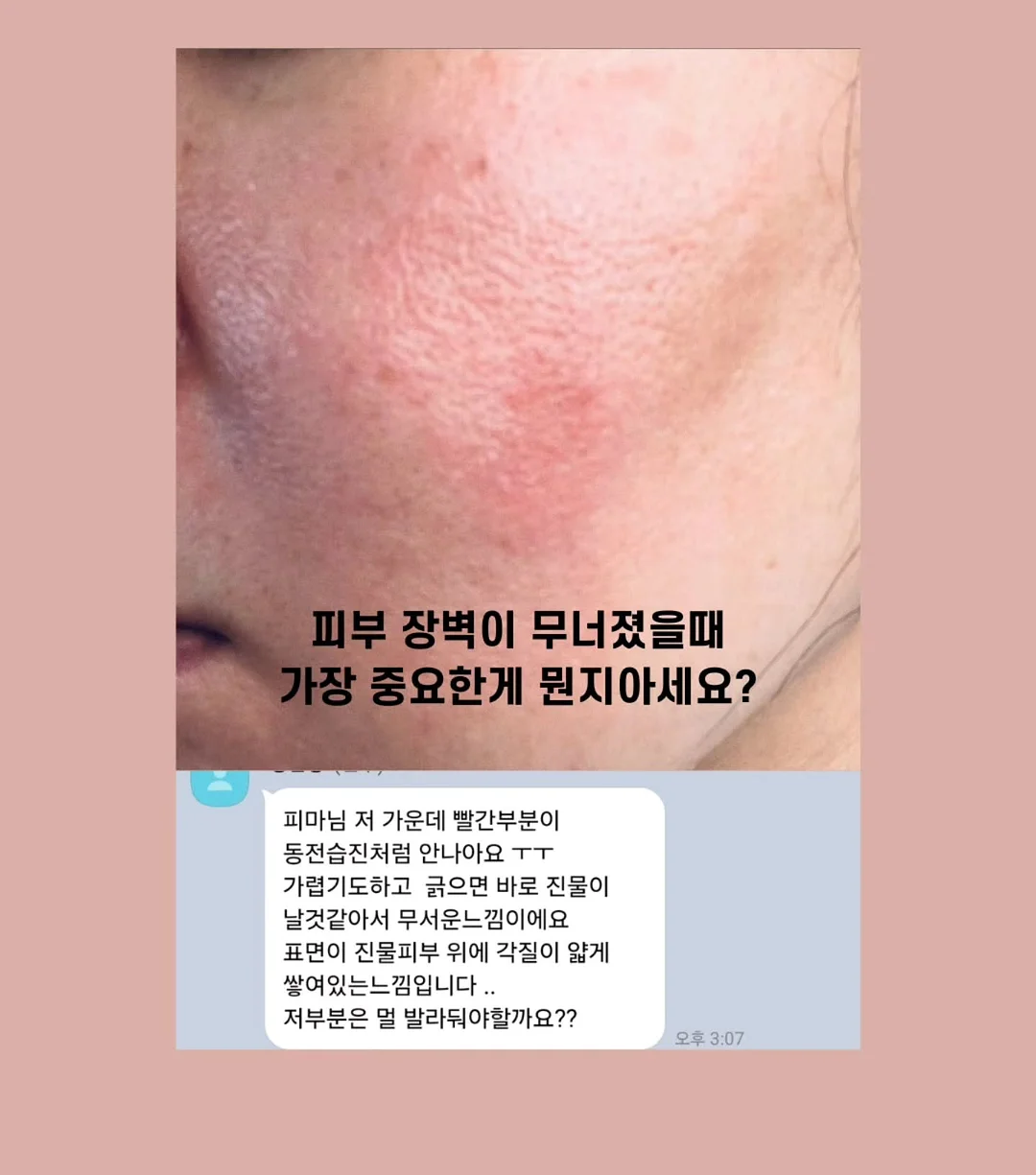 욕실 청소용품 세트 2