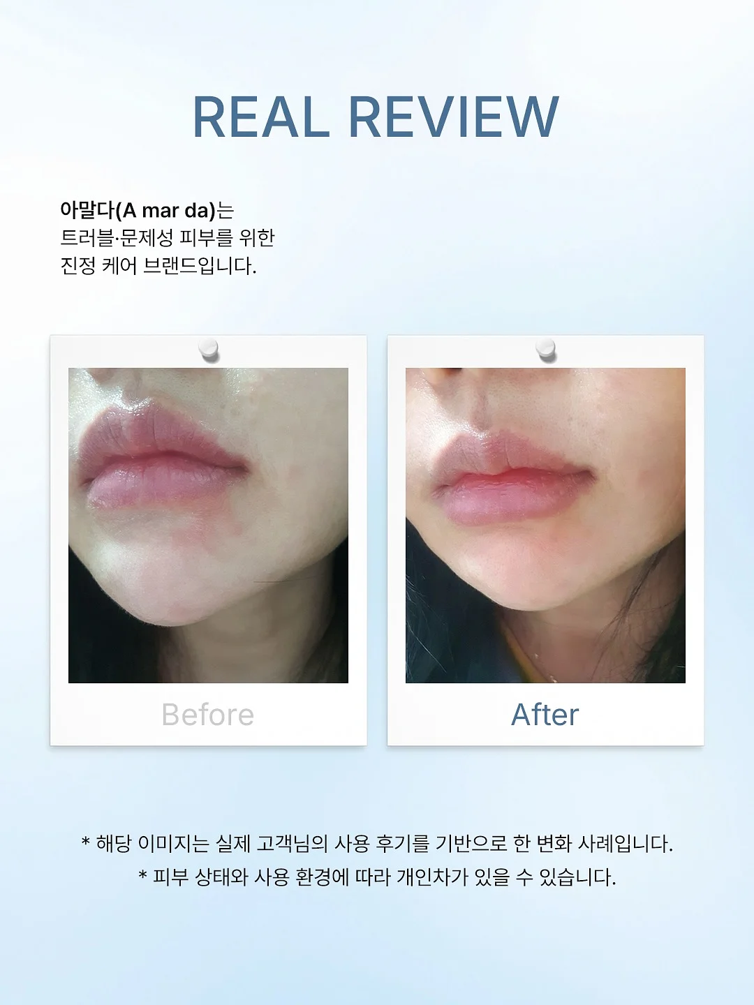 푸푸엔자임 1