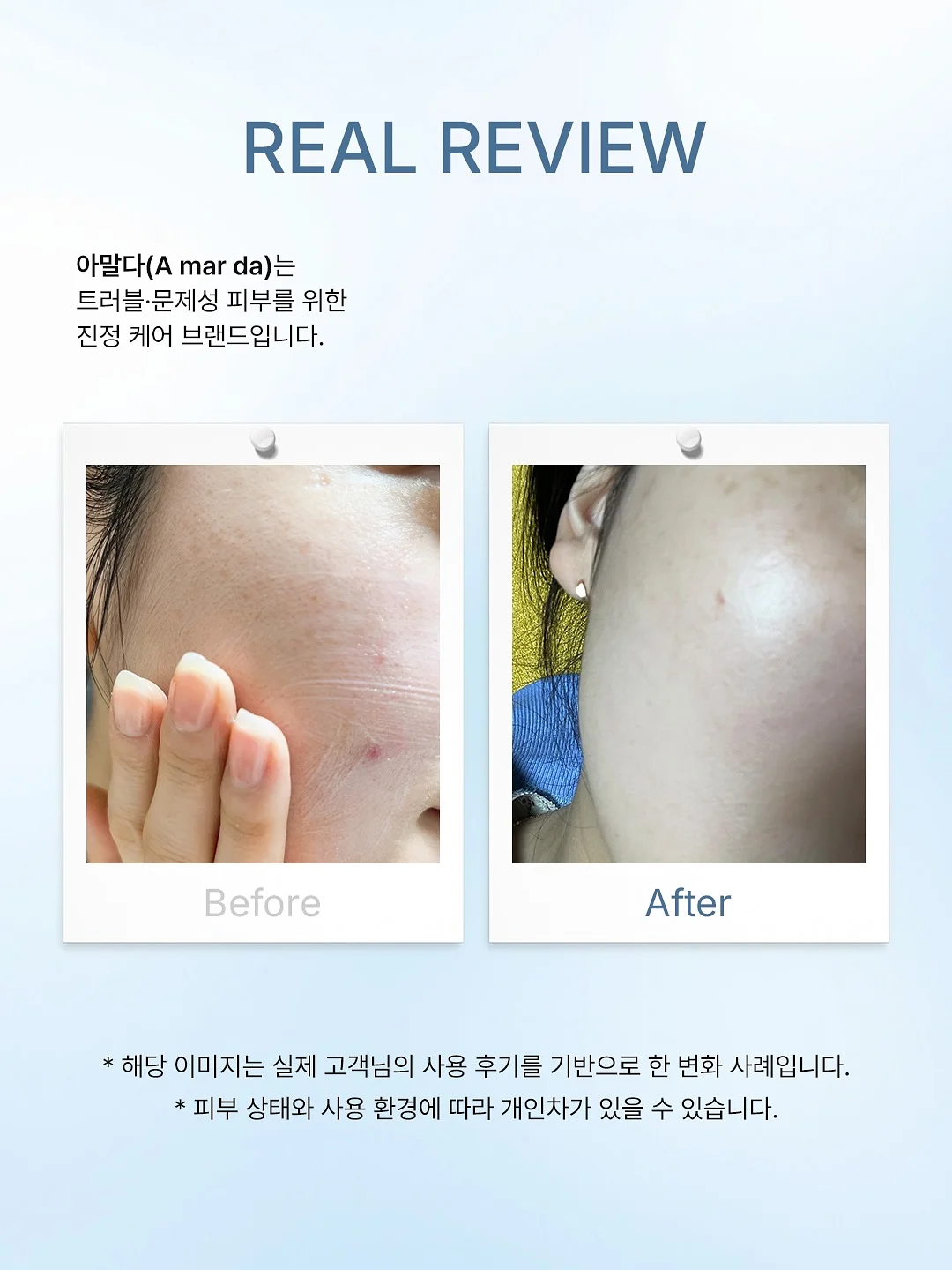 푸푸엔자임 2
